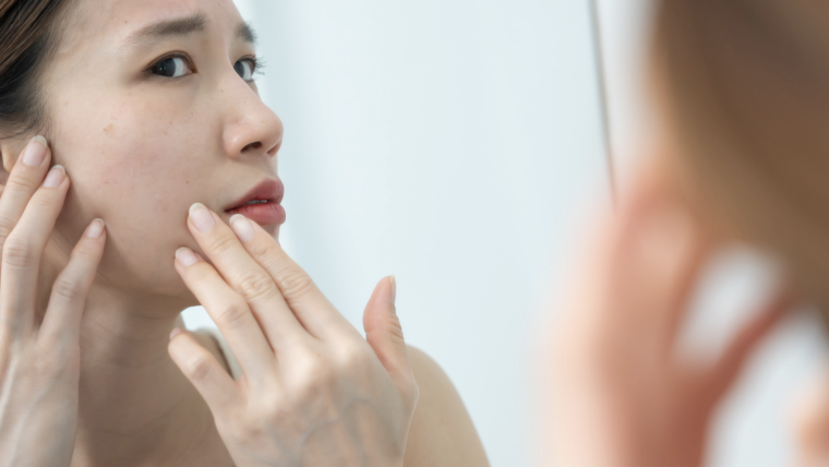 Dermatology Appointment for Eczema and Dry Skin Relief Near Falls Church Virginia